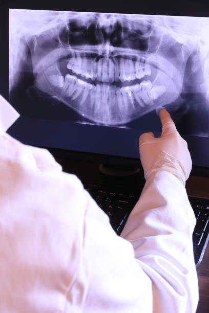 Best Emergency Denture Repair in Gibson City, IL